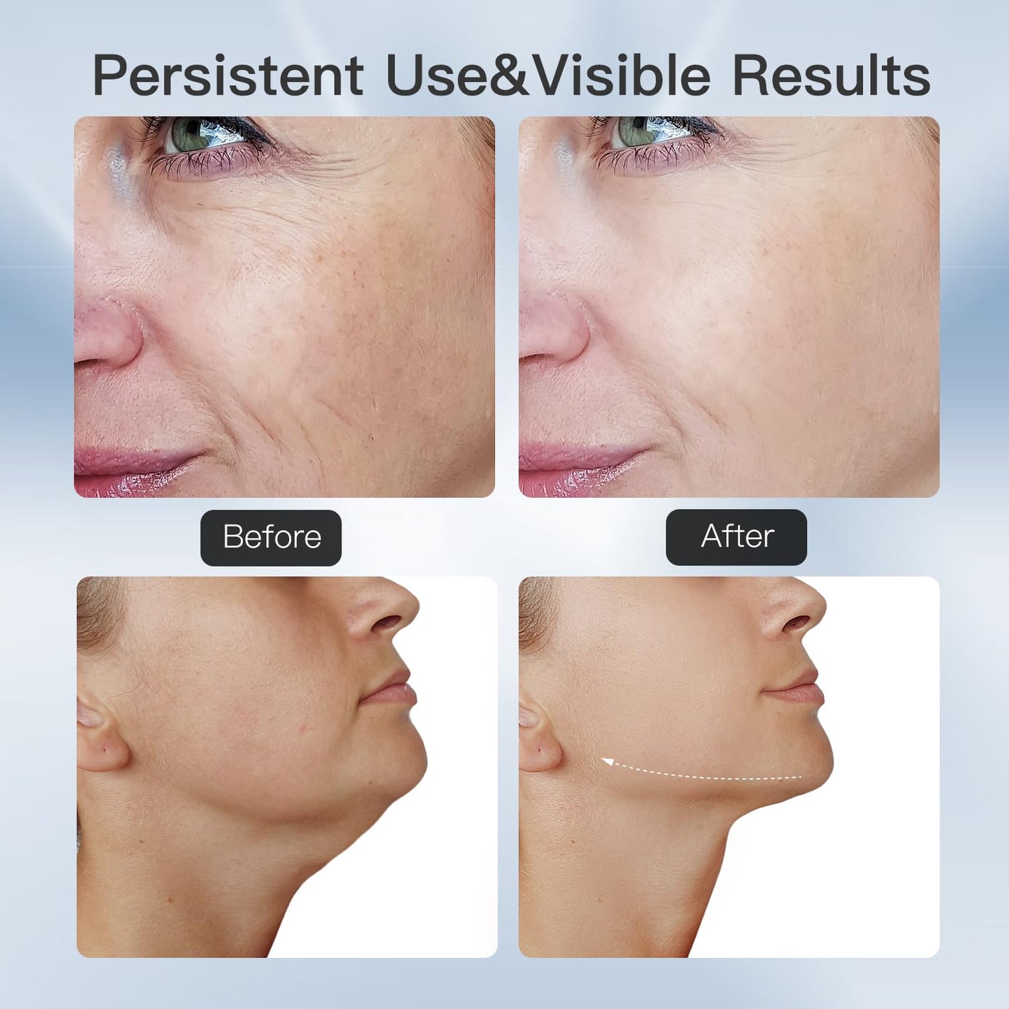 Glow Wave Beauty Device